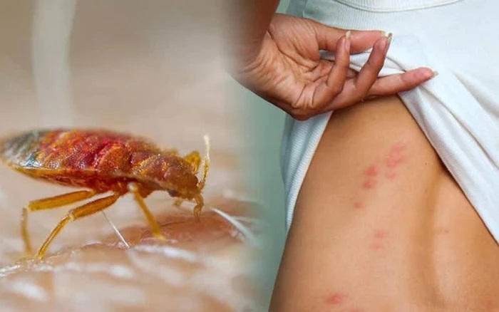 5 loại côn trùng trên giường "Đáng Sợ" thường hay xuất hiện 1 Rệp giường là một trong những loại côn trùng hay xuất hiện trên giường nhất