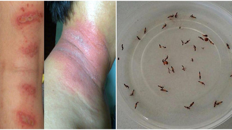 cach-diet-kien-ba-khoang-03