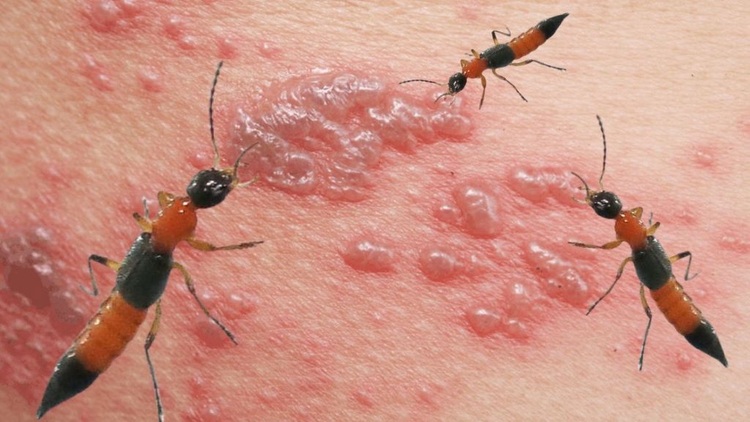 Cách diệt kiến ba khoang triệt để tại nhà dễ dàng áp dụng 4 cach-diet-kien-ba-khoang-04